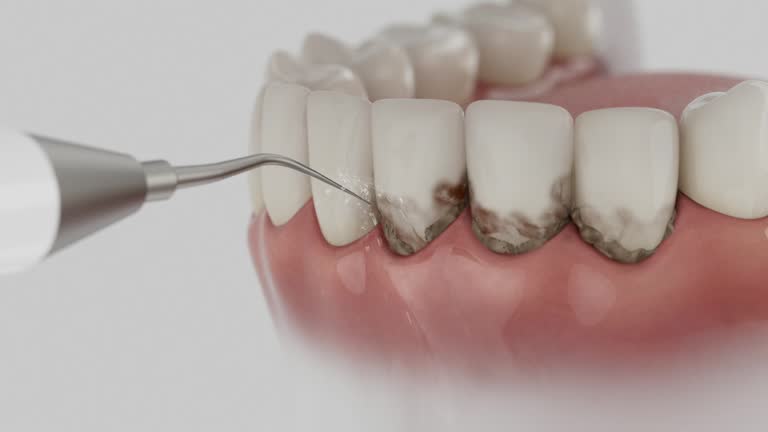 Trusted Emergency Dentist service in Rolesville, NC - Dentist Open Now